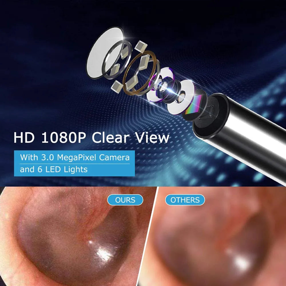 Smart Visual Ear Sticks - Precision Ear Wax Removal and Cleaning Otoscope